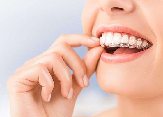 歯列矯正中でもホワイトニングは可能？不可？